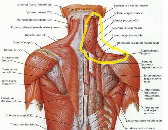 Image result for pulled neck muscles blogspot.com