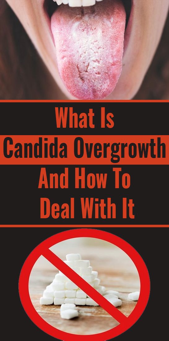 What Is Candida Overgrowth And How To Deal With It | Wellness Click