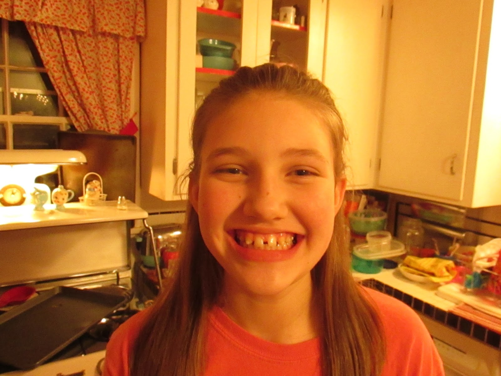 braces yeah well
