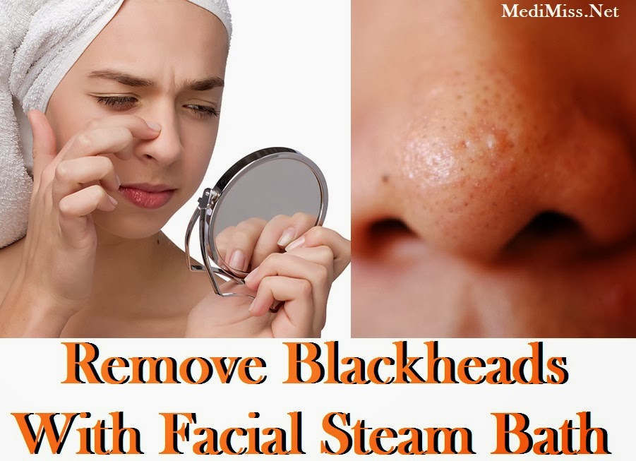 Facial Remove Blackheads 34