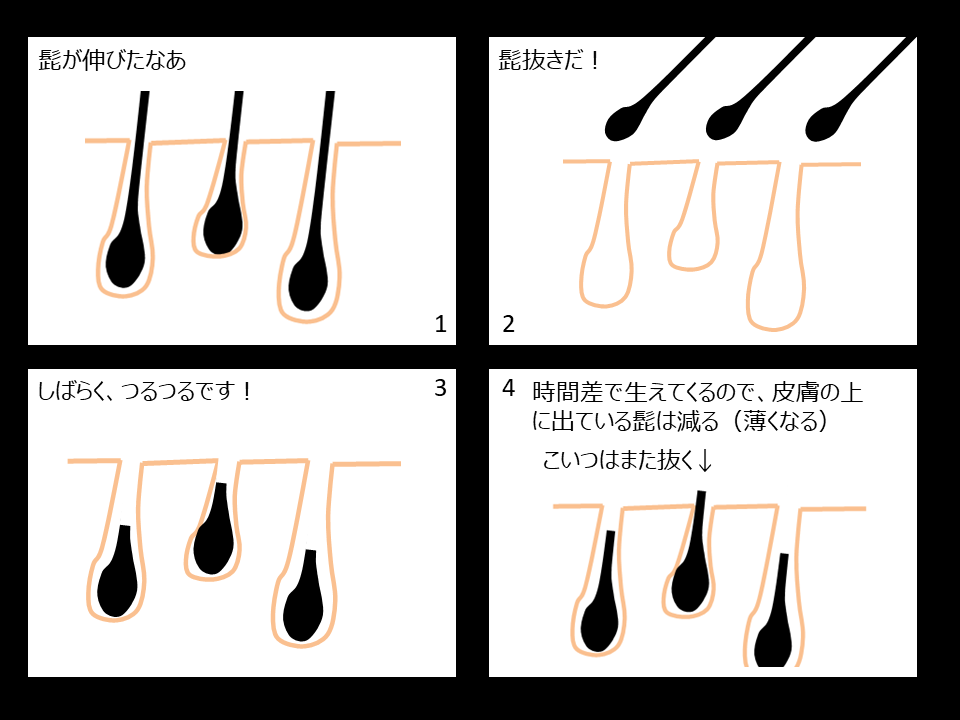 髭 抜く メリット