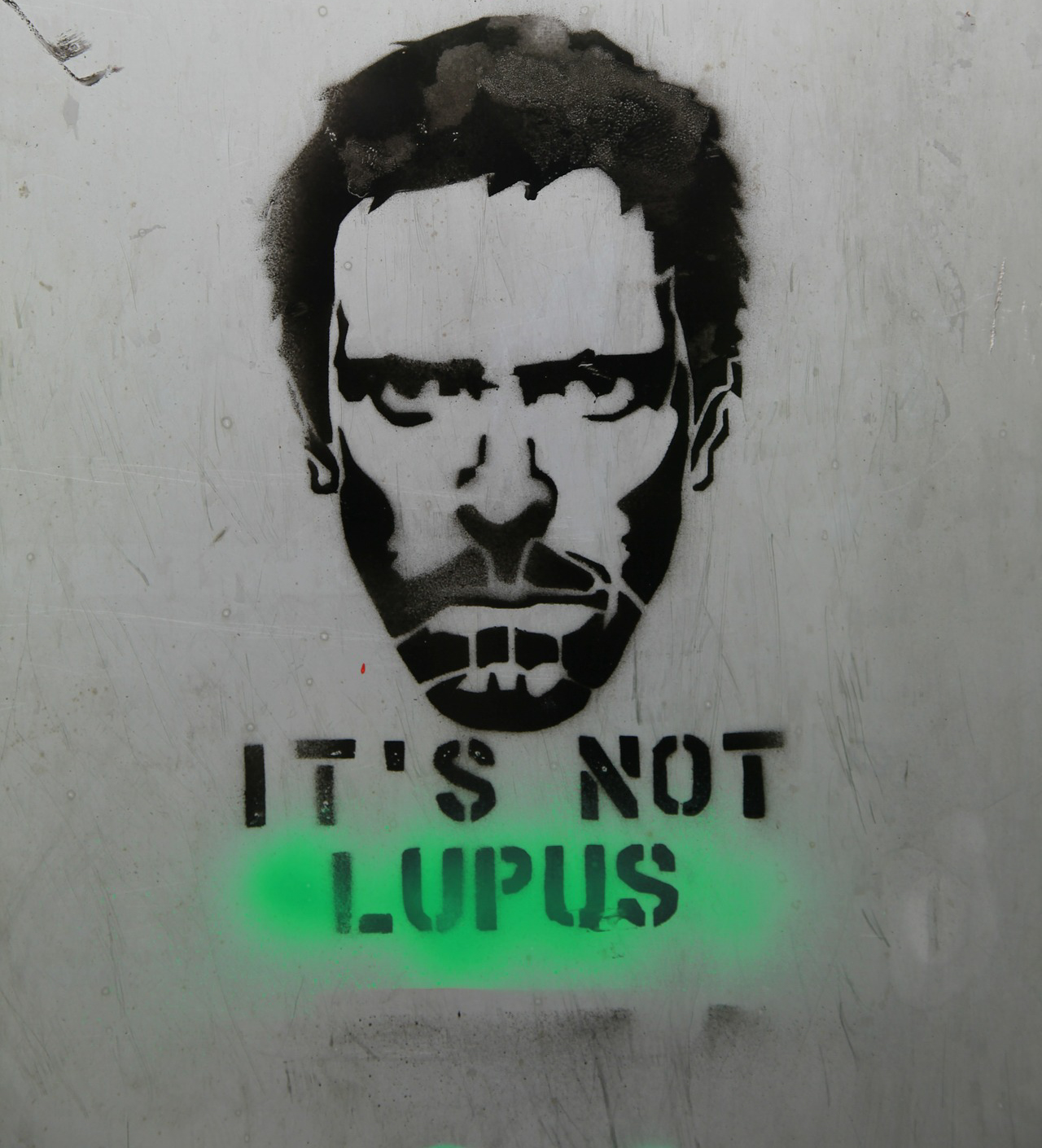 Lupus The disease with a thousand faces