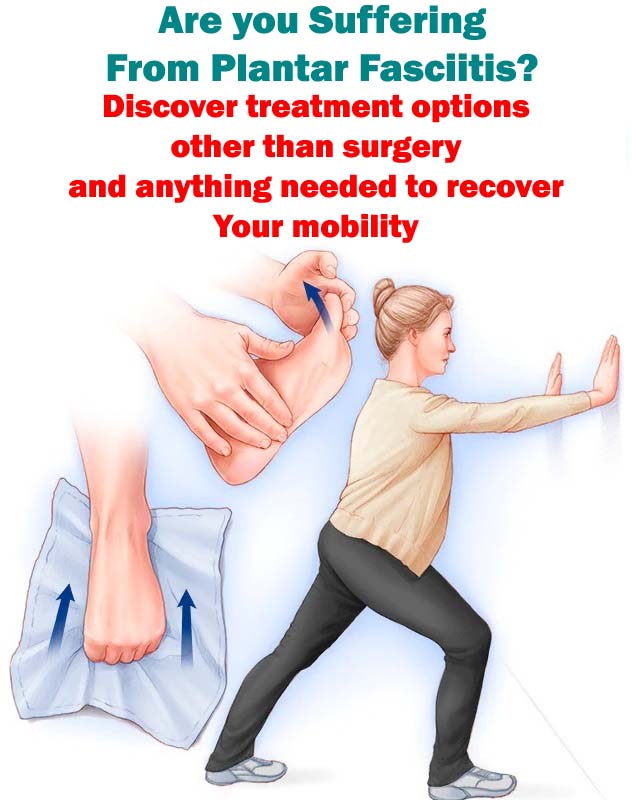 plantar fasciitis without heel pain