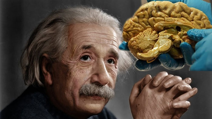 Otak Albert Einstein