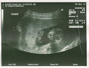 Evan calls this the smiling skeleton; I think it looks like an alien