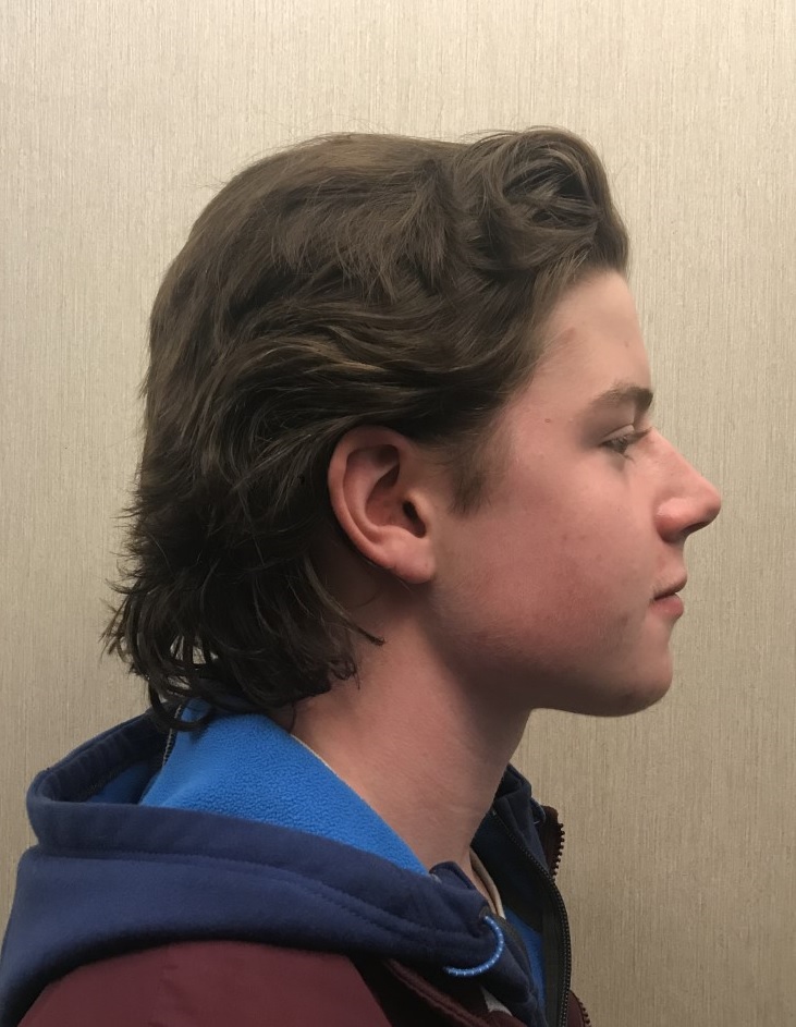 Hanover Marauders Boys Hockey 202021 Hanover Hockey Hair Spotlight