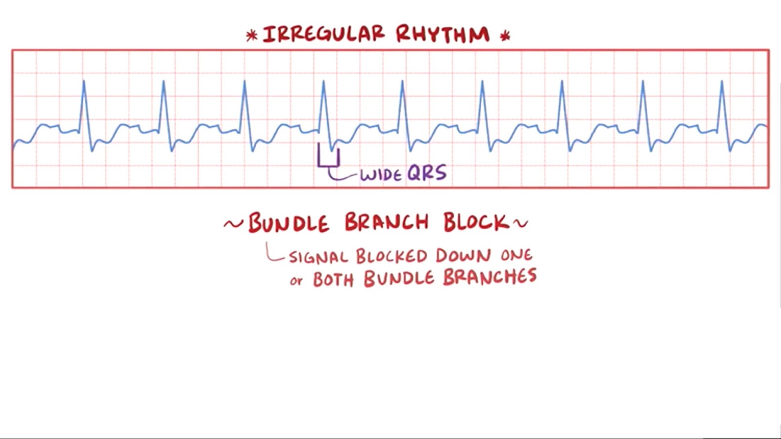 Kalp Atisi Vektorler Grafikleri Ve Cizim 123rf
