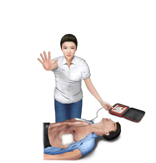 AREX How to Use AED