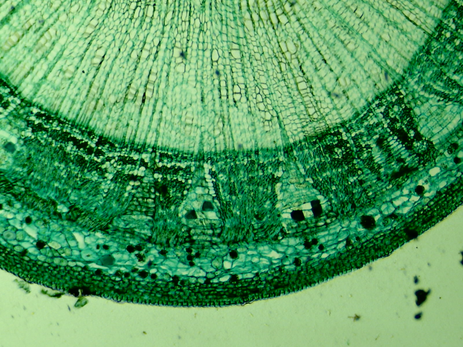 It's just a picture of Lively Tomato Skin Cell Under Microscope Labeled It is an image of Lively Tomato Skin Cell Under Microscope Labeled