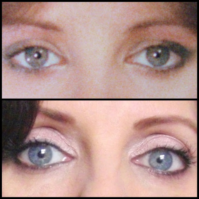 Our Eyes Show Our Age....The Limbal Ring