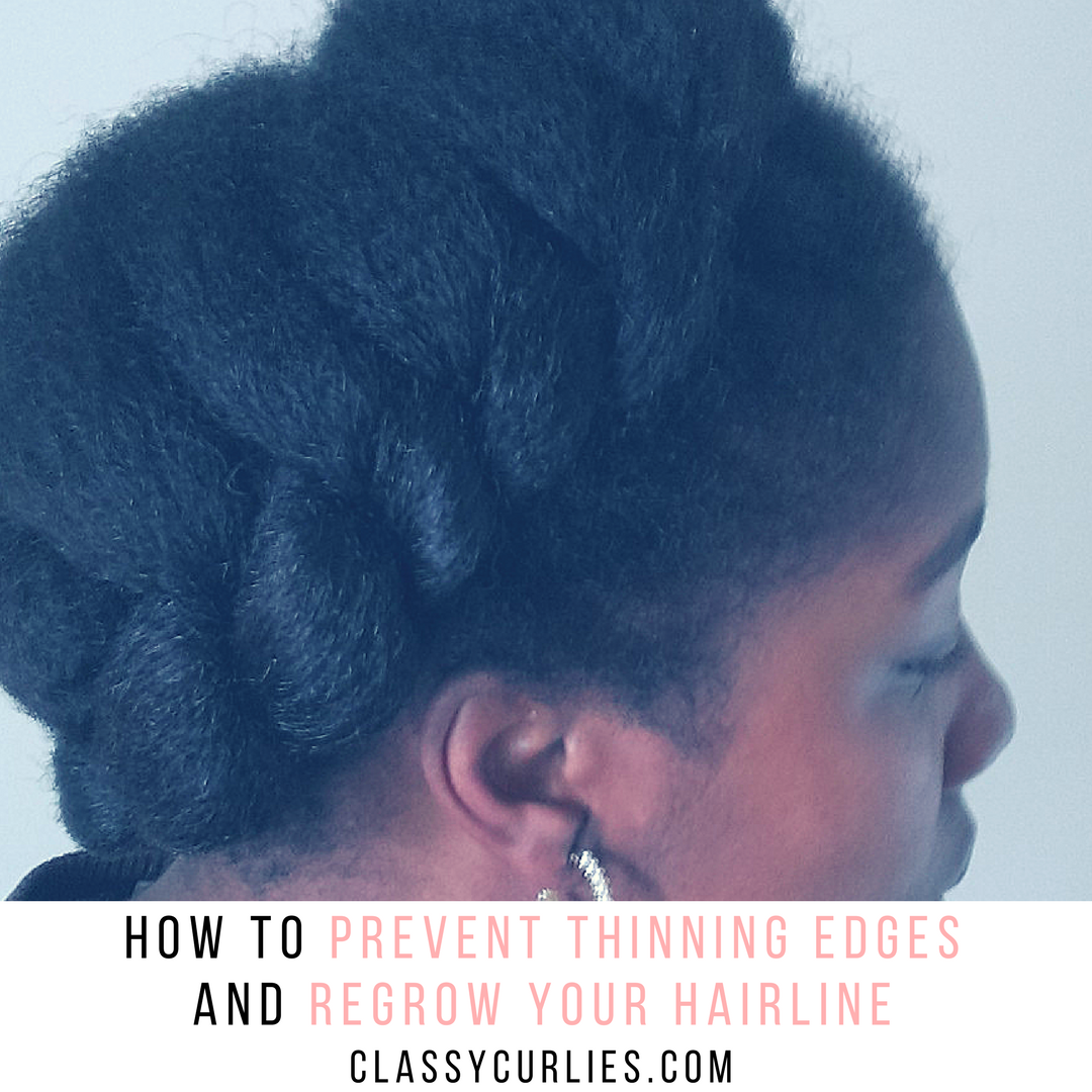 How To Prevent Thinning Edges And Regrow Your Hairline Classycurlies