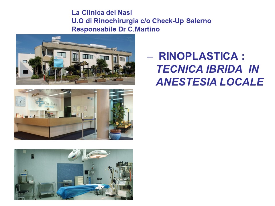 La Clinica Dei Nasi Dr Martino Salerno Rinoplastica Tecnica Ibrida In Anestesia Locale