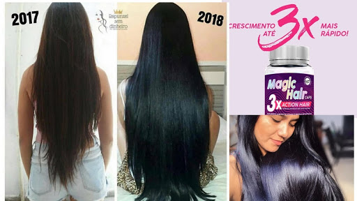 O CABELO CRESCE 3X MAIS RÁPIDO, REDUZ ATÉ 90 % DA QUEDA