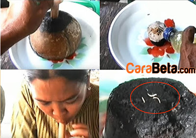 Cara Mengeluarkan Ulat Gigi Berlubang Dan Gambarnya ~ Obat Sakit Gigi