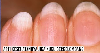 Arti kesehatannya jika Kuku bergelombang