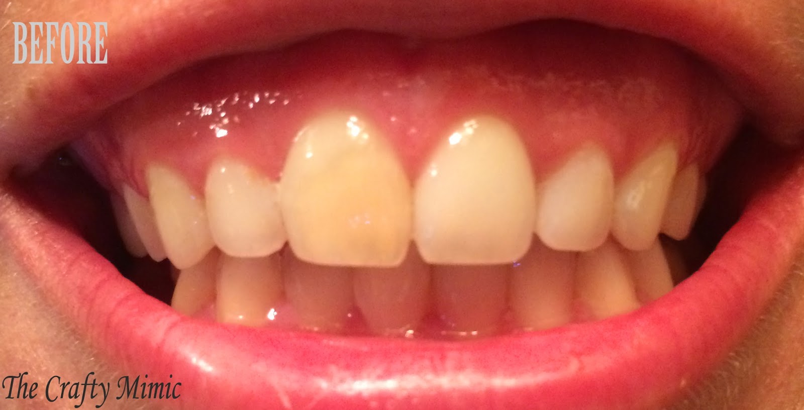 The Crafty Mimic Activated Charcoal Teeth Whitening