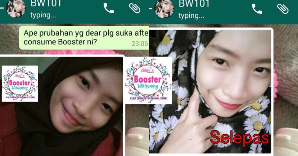 Ubat Jerawat Malaysia  Sarumpj