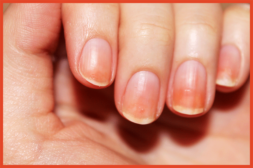 Jaunissent Qui Jaunissent Ongles Ongles Faux Qui Qui Jaunissent Faux Ongles Faux Faux Ongles GqSpMUzV