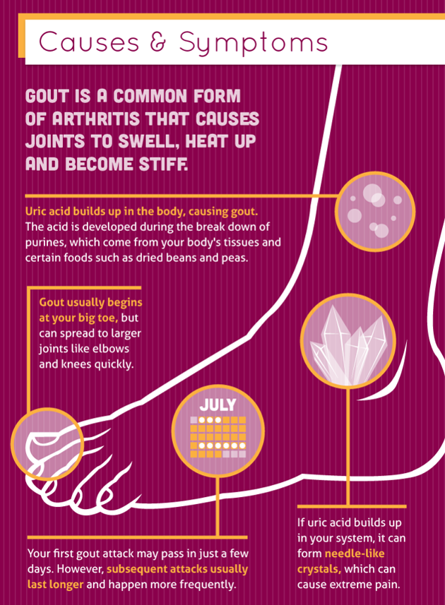 About Health: Gout