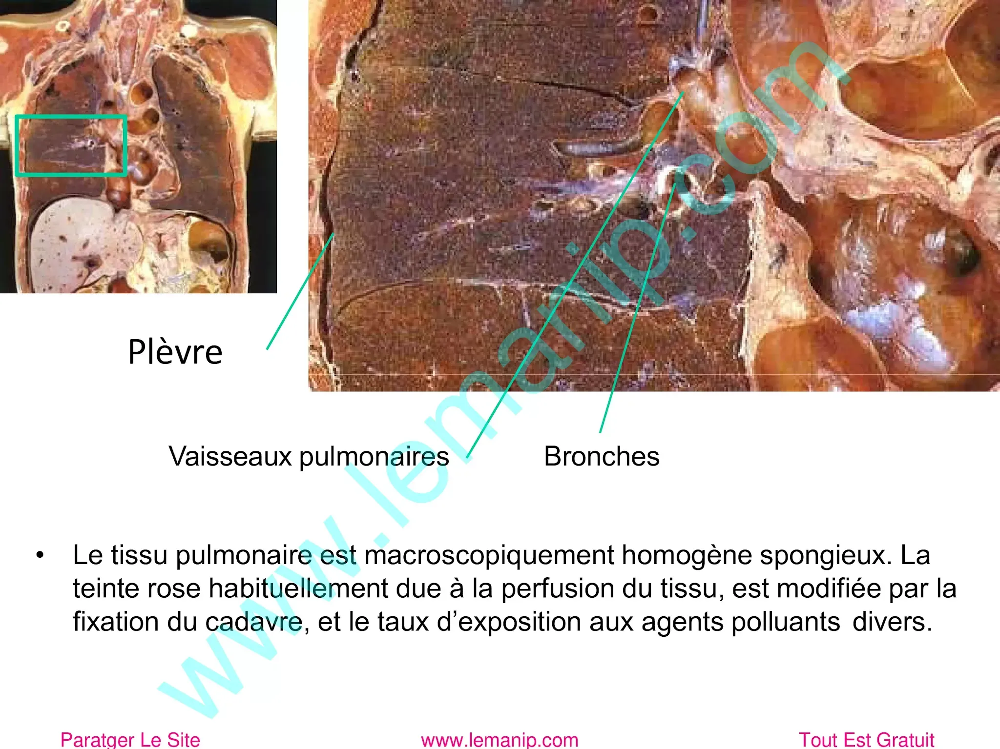 Le tissu pulmonaire