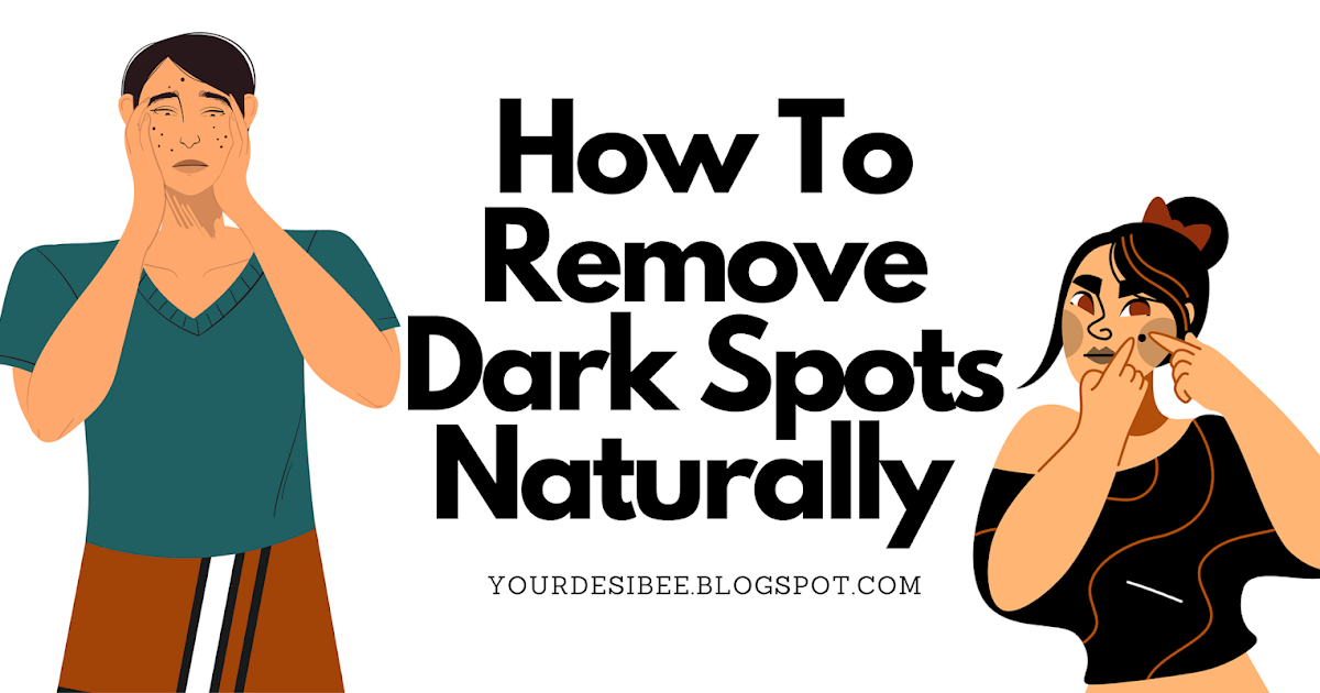 How To Remove Dark Spots Naturally