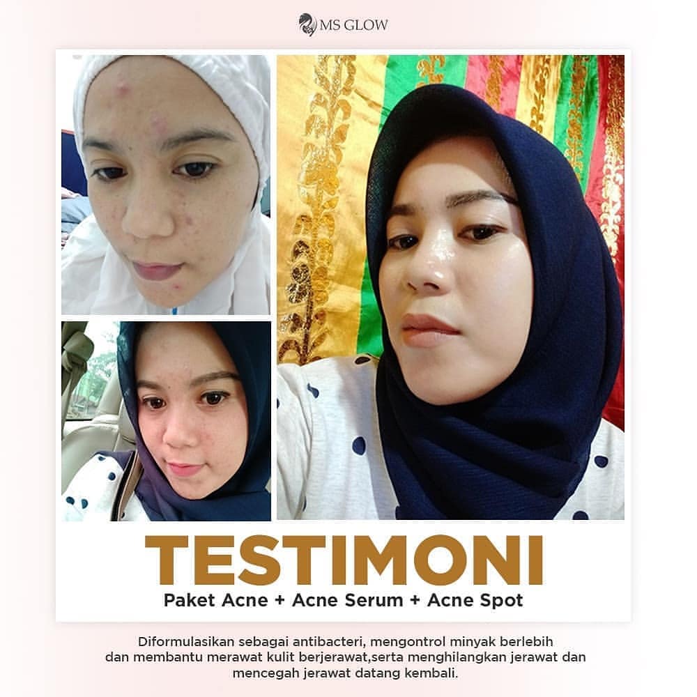 Testimoni Para Pengguna Produk Ms Glow