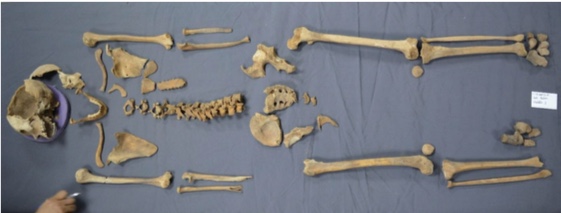 The woman's skeleton or remains of the skeleton to be accurate