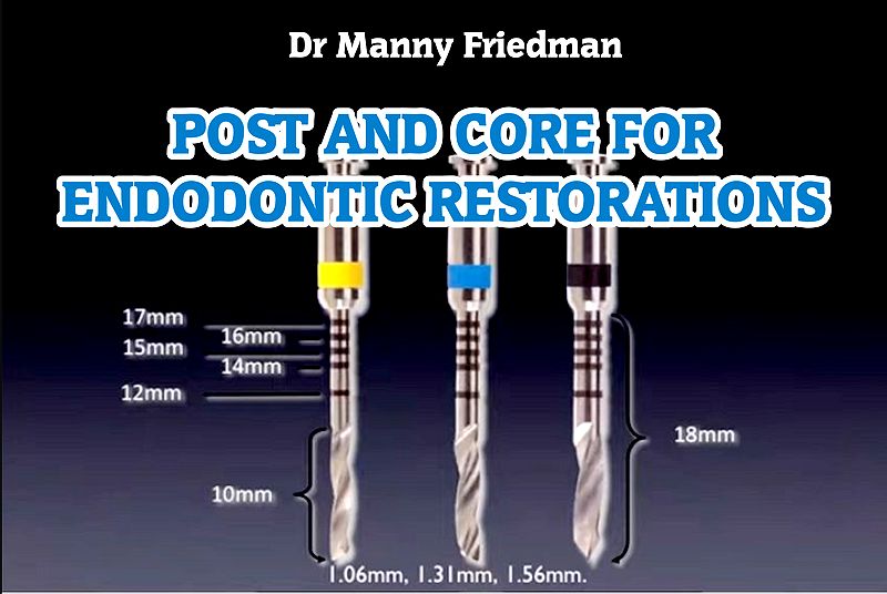 DENTSPLY Post and Core for Endodontic Restorations Dr Manny Friedman