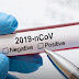 Covid-19| 64 pessoas estão sob suspeita e 04 se recuperam do coronavirus, diz Secretaria de Saúde.