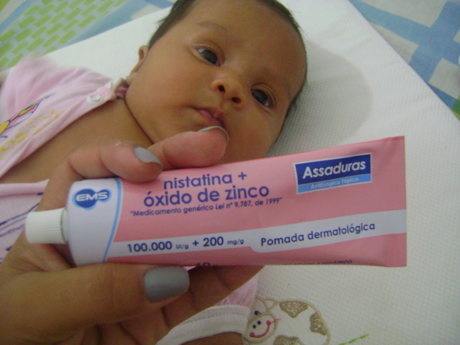 Imagem de pomada Nistatina+ Óxido de Zinco