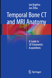 Temporal Bone CT and MRI Anatomy A Guide to 3D Volumetric Acquisitions Temporal Bone CT and MRI Anatomy A Guide to 3D Volumetric Acquisitions