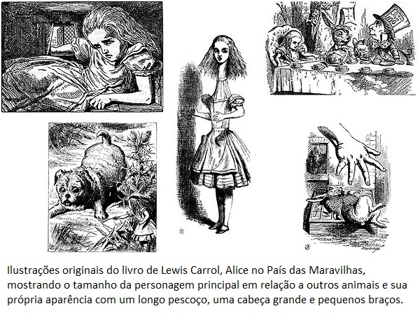 Qual é a síndrome de Alice no País das Maravilhas?