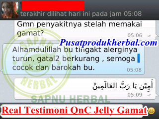 Cara Mengobati Gatal Akibat Biang Keringat Sampai Tuntas Cara Mengobati Gatal Akibat Biang Keringat Sampai Tuntas