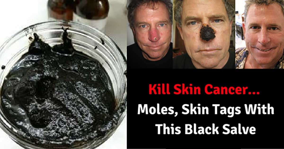 black-salve-mistake-pictures