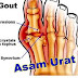 Obat Asam Urat Alami