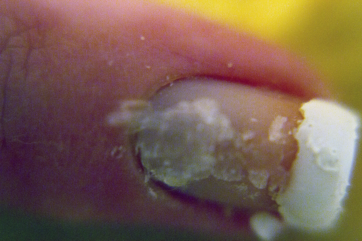 Manicure What Ails You Shellac removal!