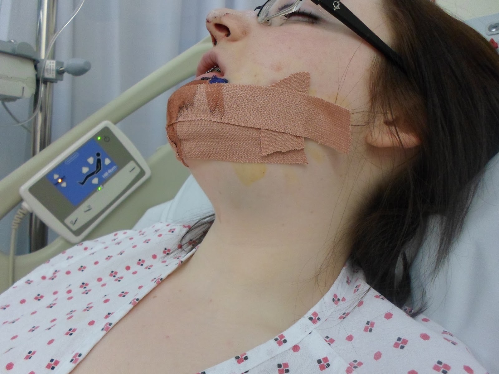 My jaw surgery and I.. Day 0 Surgery day has Arrived!