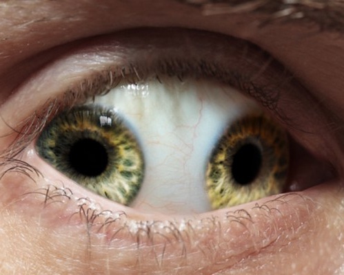 Pupula Duplex: Truth or Fake? Read more about Pupula Duplex