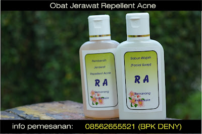 obat jerawat herbal di apotik, obat jerawat herbal yg ampuh, obat jerawat herbal paling ampuh, obat jerawat herbal terbaik, obat jerawat herbal yang ampuh, obat jerawat herbal bersih wajah, obat jerawat herbal yang di jual di apotik, obat jerawat herbal alami, obat jerawat herbal alami, obat jerawat herbal yang bagus.