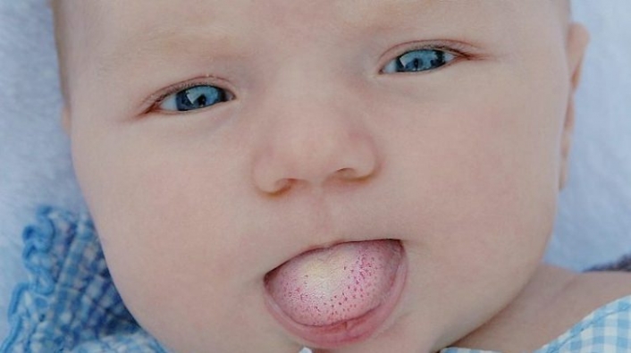 saglik rehberi pamukcuk nedenleri nelerdir