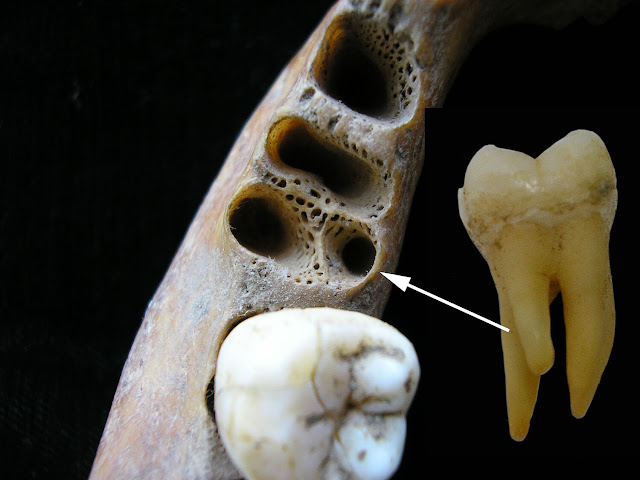 Ancient molar points to interbreeding between archaic humans and Homo sapiens in Asia