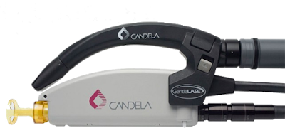 Candela laser repair services