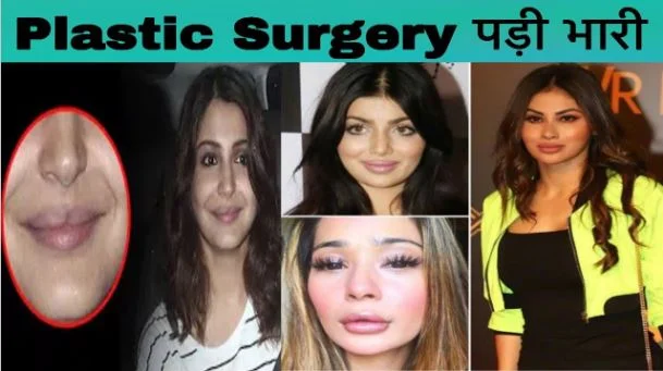 Bollywood-actress-horrible-surgery