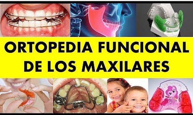 ORTODONCIA: Ortopedia funcional de los Maxilares - Dr. Dario Meza