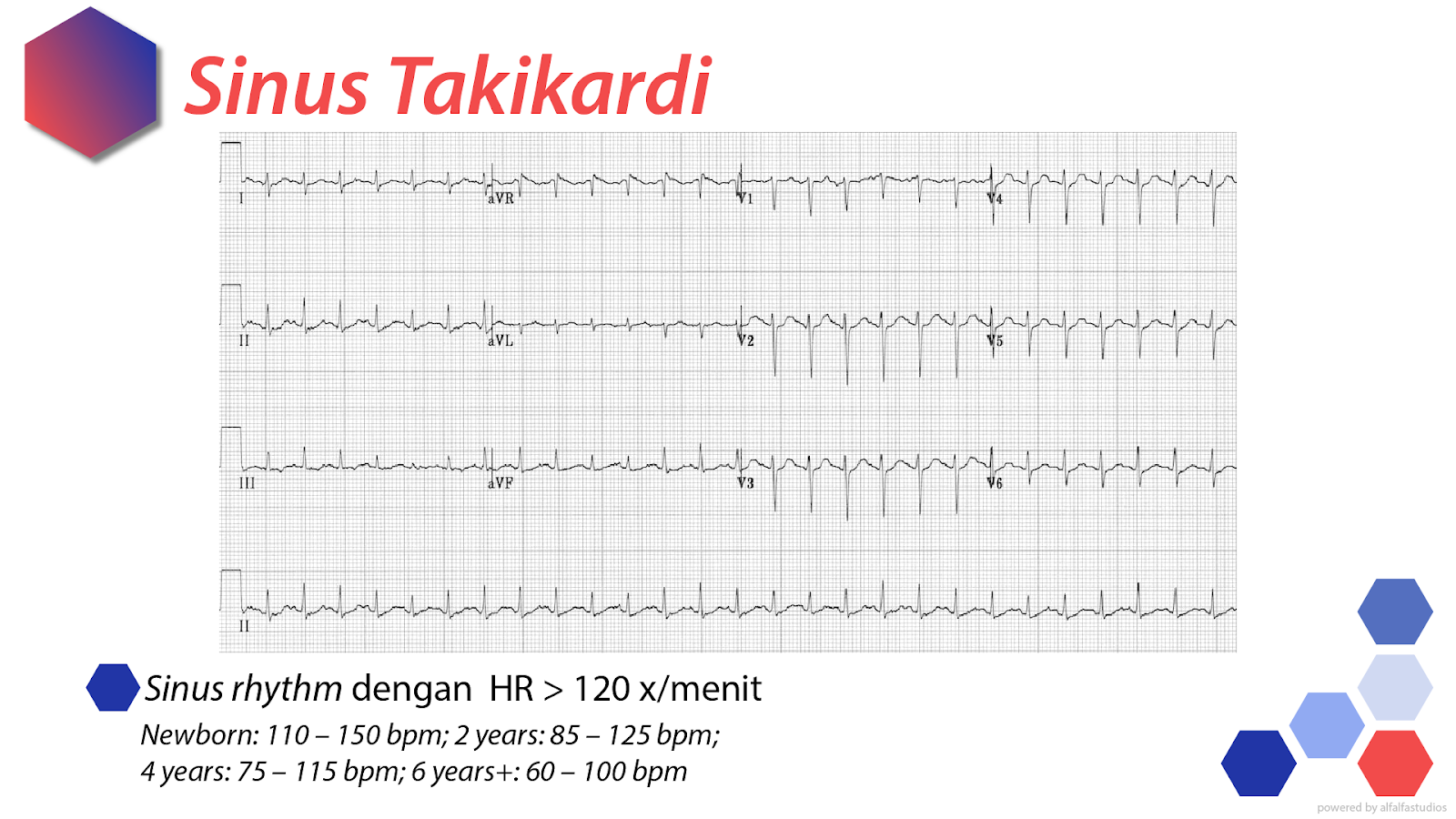 Aritmia EKG Dokter Alfa Belajar Kedokteran