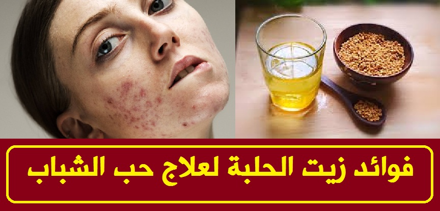 تحليل ضغينة تثبيت زيت الحلبة للوجه parthenayclub manakara com