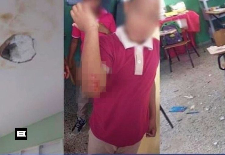 Niño resulta herido tras caer rayo en escuela de Arenoso Niño resulta herido tras caer rayo en escuela de Arenoso