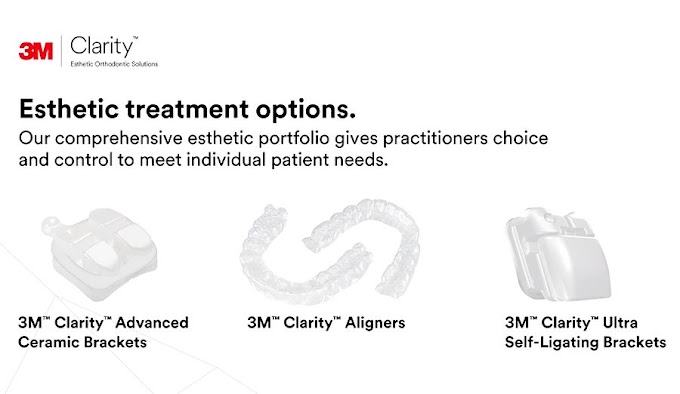 ORTHODONTICS: Overview of 3M™ Clarity™ Ultra Self-Ligating Brackets