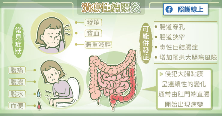 潰瘍性結腸炎常見症狀及併發症