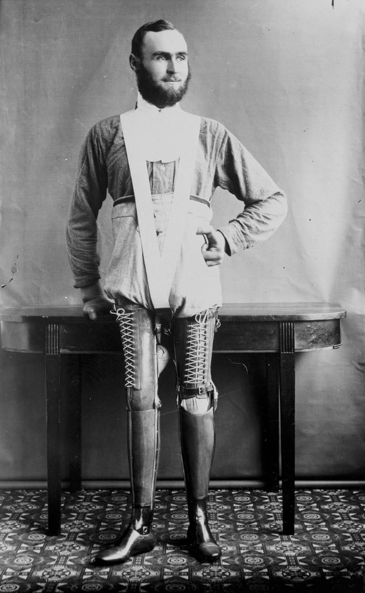 The extraordinary early prostheses made by James Gillingham  1900 - 90